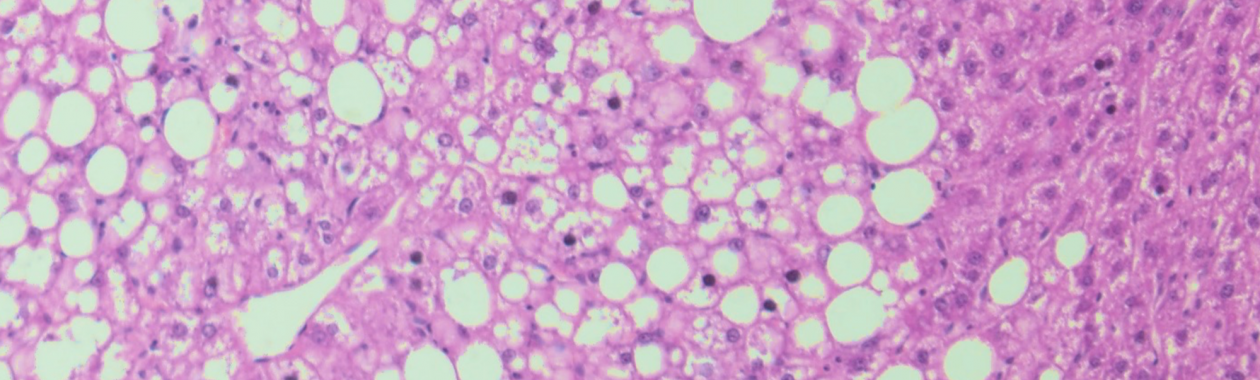 H&E staining of mouse fatty liver