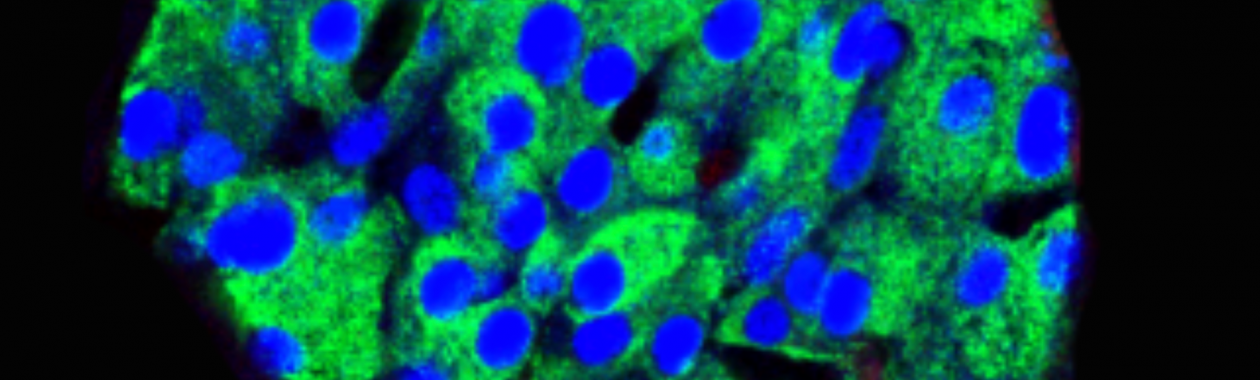 Mouse islet: Insulin (green), Pdx1 (blue), Ki67 (red)